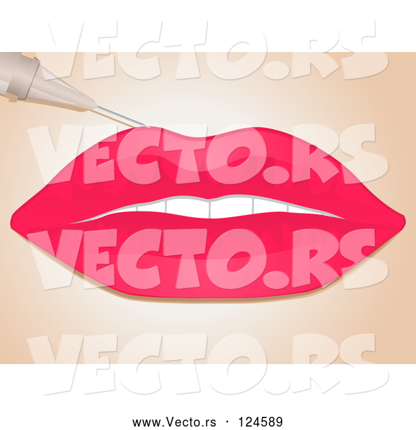 Vector of Needle Injecting Collagen Filler into a Womans Lips
