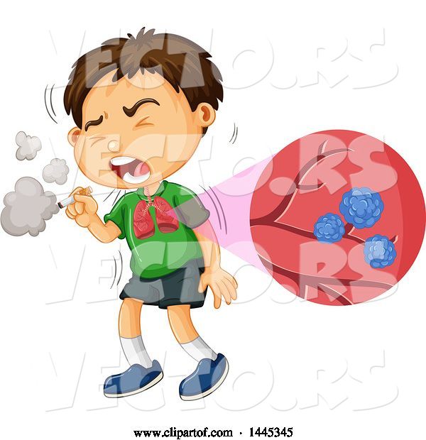 Vector of Brunette White Boy Smoking a Cigarette and Coughing, with a Diagram of an Infection